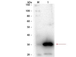 Carbonic Anhydrase I/CA1 Antibody, Novus Biologicals 0.1 mg | Buy Online | Novus Biologicals | Fisher Scientific